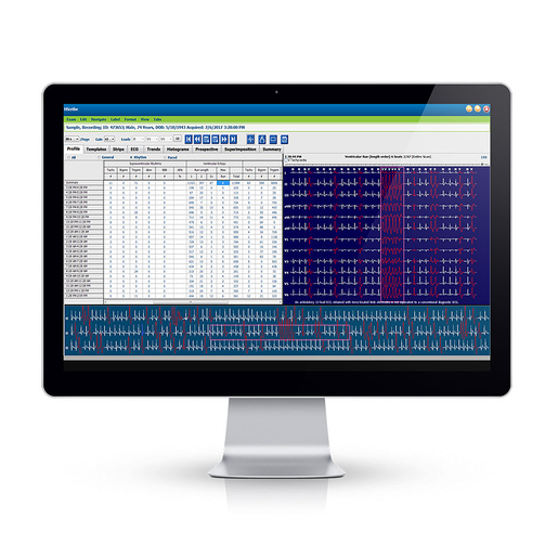 HScribe™ Holter Analysis System