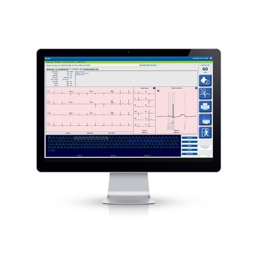 RScribe™ Resting ECG System